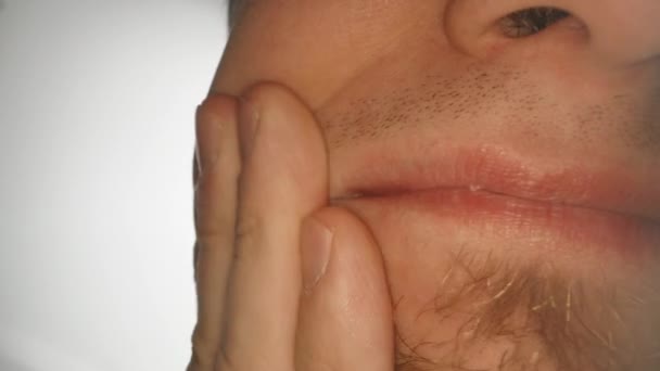 Sore Spot Tooth Extraction Shooting Super Macro Man Mouth — Stockvideo