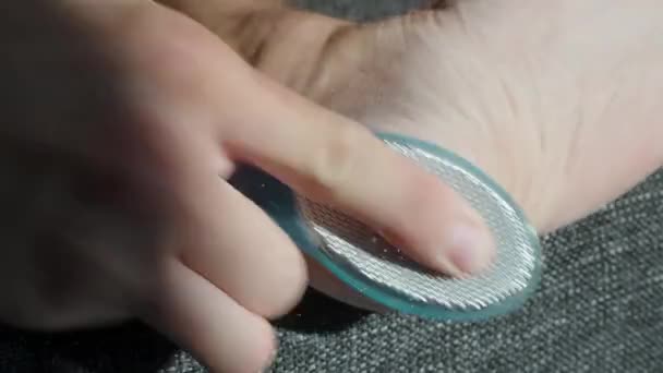Homem Sofá Apaga Pele Velha Sua Perna Dedos Pedaços Pele — Vídeo de Stock