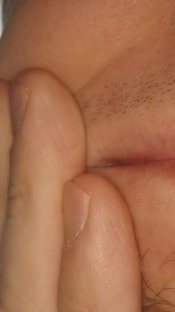 Πονηρό Σημείο Εξαγωγή Δοντιών Πυροβολείς Σούπερ Μακροεντολή Στο Στόμα Ενός — Αρχείο Βίντεο