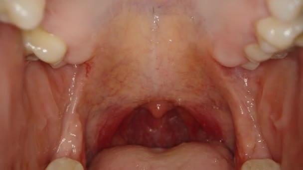 Pemeriksaan Rongga Mulut Seorang Pria Probe Makro Dalam Mulut — Stok Video