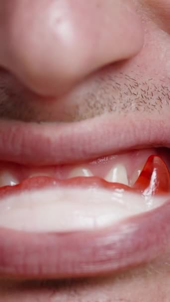 バーティカルビデオ 若い男は彼の口にヴァンパイアの牙の形をしたガミーキャンディで笑う クローズアップショット — ストック動画