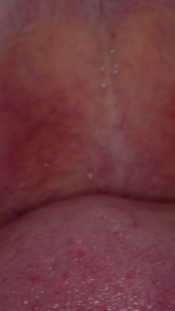 垂直录像 口腔内的摄像头显示牙齿向侧边 舌头向后压 大口径口腔卫生测试 — 图库视频影像
