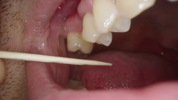 Homem Tenta Remover Resíduo Alimentar Dente Distante Usando Palito Madeira — Vídeo de Stock