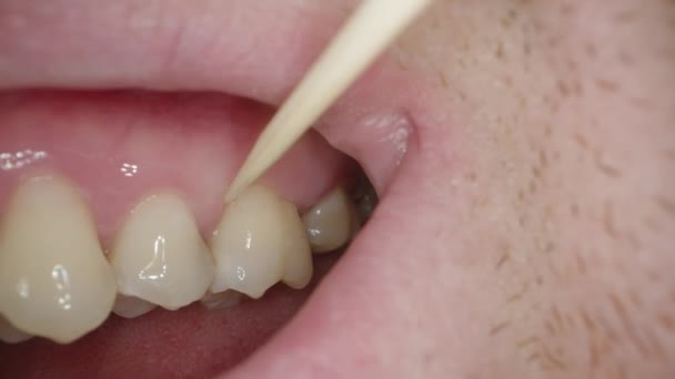 Homme Avec Chaume Choisit Ses Dents Avec Cure Dent Macro — Video