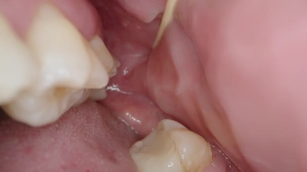 Mouth Tongue Glides Teeth Tries Retrieve Something Inglês Macro — Vídeo de Stock