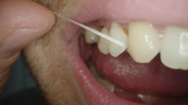 Diş ipi ile, adam üst dişlerinin arasındaki boşluktan bir parça yiyecek çıkartıyor. Makro.