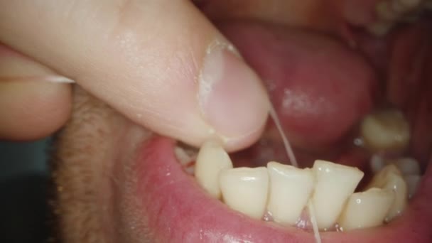 Uomo Filtra Denti Una Guida Macro Visiva — Video Stock