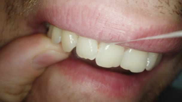 Mezery Mezi Zuby Vyžadují Čištění Zubní Vrstvou Makro Neoholený Muž — Stock video