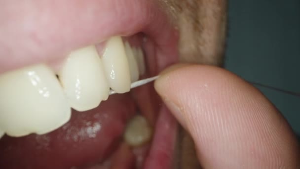 Muž Čistí Zbytky Potravin Mezer Mezi Zuby Zubním Leskem Makro — Stock video