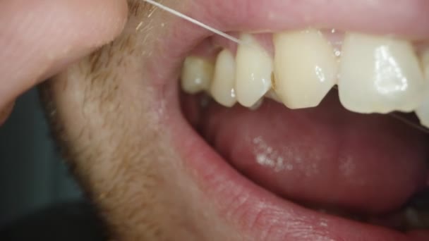 Man Usa Floss Dental Para Extrair Resíduo Alimentar Lambe Com — Vídeo de Stock
