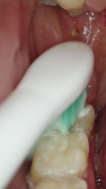 Pionowe Wideo Nagranie Wideo Wnętrza Ust Podczas Czyszczenia Zębów Makro — Wideo stockowe