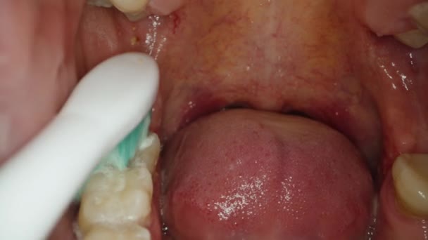 Nagranie Wideo Wnętrza Ust Podczas Czyszczenia Zębów Makro — Wideo stockowe