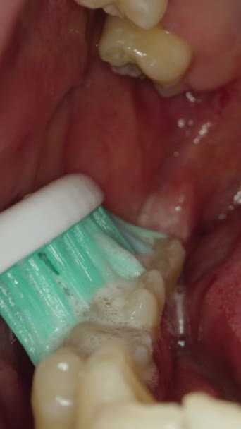 Pionowe Wideo Przykład Wizualny Czyszczenie Zębów Widok Wewnątrz Usta Szczoteczki — Wideo stockowe