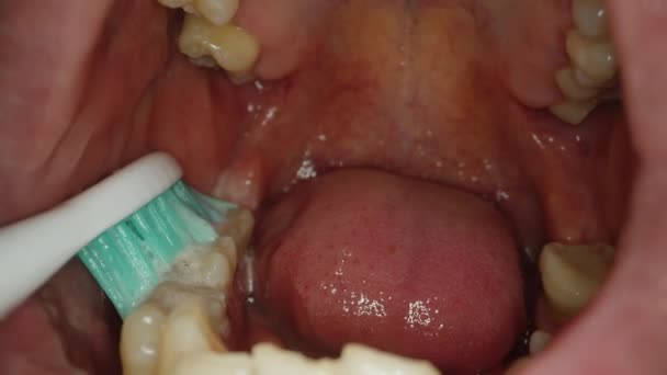 Exemplo Visual Limpeza Dentes Vista Dentro Boca Escova Dentes Com — Vídeo de Stock