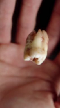 Dikey video. Diş fırıl fırıl döner ve elin üstüne düşer, insan onu avucunun içine alır. Yavaş çekim.