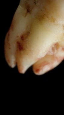 Dikey video. Kandaki insan dişi aşağıya doğru düşüyor, yavaş çekim makrosu izole edilmiş siyah arka planda..