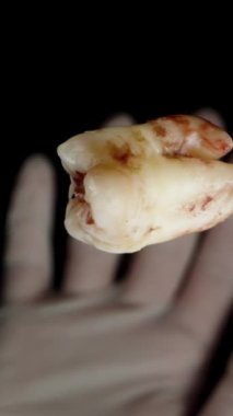 Dikey video. Devrilmiş İnsan Dişleri Dönüyor ve Düşüyor, Beyaz Eldivenli El Tarafından Yakalandı, Makro Süper Yavaş Hareket.