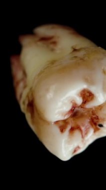 Dikey video. İnsan dişi kan içinde döner ve düşer. Makro Süper Yavaş Hareket. İzole edilmiş.