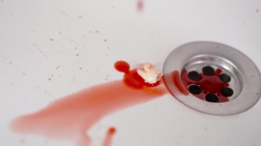 Üzerinde kan damlaları damlayan Düşmüş Dişin Yakın Çekimi, Beyaz Banyo Lavabosu.