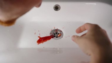 Banyodaki Lavaboya dayanan Adam Kandan Düşen Dişi Şiddetli Bir Durumda Aldı.