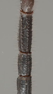 Dikey video. Makro kaydırağın altından yukarı bakan akrepler, karın bölmeleri, ince tüyler, bacaklar ve güçlü kıskaçlar. Dış iskelet ve anatominin detaylı dokuları. Eklembacaklı ve Vahşi Yaşam