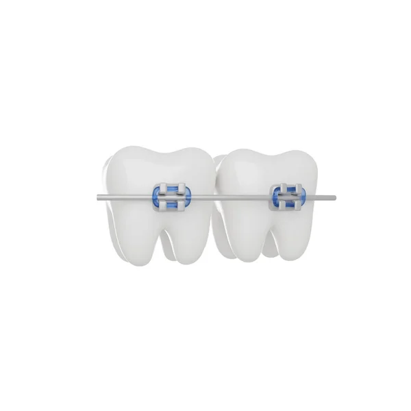 歯のブレース3Dレンダリングアイコン隔離された白い背景 — ストック写真