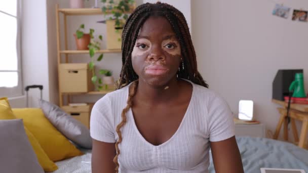 Happy Portrait Smiling Young Woman Vitiligo Sitting Bed Her Room — Stock Video