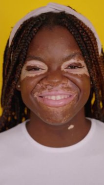 Sarı stüdyo arka planında kameraya gülümseyen Vitiligo 'lu mutlu Afrikalı kadının izole edilmiş dikey portresini kapat..