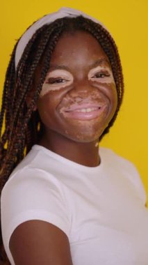 Vitiligo 'su olan mutlu Afrikalı bir kadının sarı stüdyo arka planında kameraya gülümseyen portresinin yan görüntüsü. Pozitif insanlar ve gençlik kavramı.