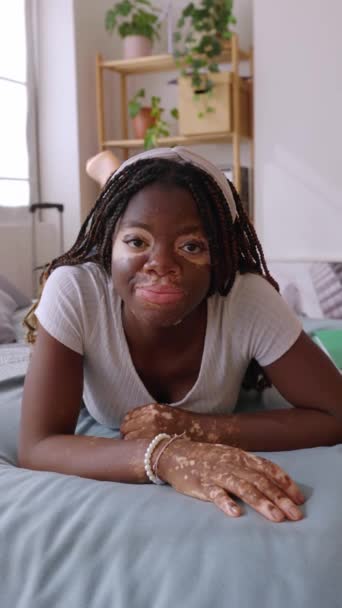 在卧室里躺在床上 一个年轻快乐的非洲女人与白垩风对着相机微笑的垂直镜头 积极的人和皮肤科概念 — 图库视频影像