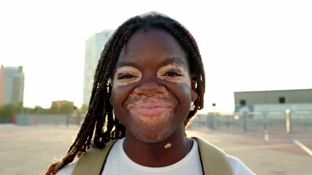 Jonge Zwarte Vrouw Met Vitiligo Glimlach Camera Zonsondergang Stad Achtergrond — Stockvideo