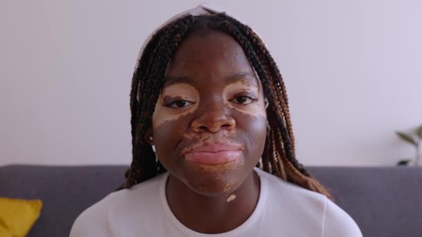 Pov Atau Tampilan Layar Potret Wanita Muda Dengan Vitiligo Mendengarkan — Stok Video