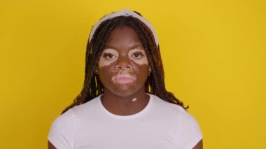 Sarı stüdyo arka planında kameraya gülümseyen Vitiligo 'lu mutlu ve genç Afrikalı bir kadının portresi..