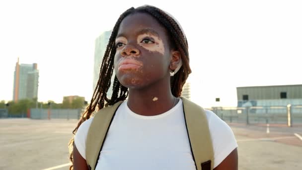 Joyful Portrait Young African Woman Vitiligo Skin Standing Happily Outdoors — Stock Video