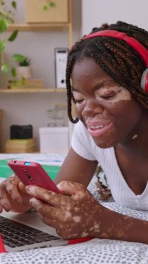 Dikey video. Vitiligo 'su olan mutlu Afrikalı genç kız yatak odasında dizüstü bilgisayar üzerinde çalışırken cep telefonu kullanıyor. Eğitim ve teknoloji kavramı.