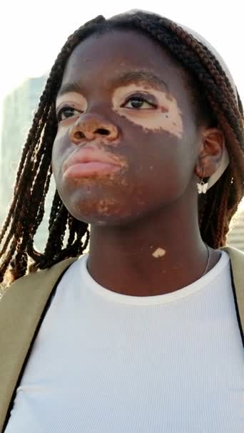 Joven Muchacha Africana Alegre Con Vitiligo Sentirse Positivo Pie Calle — Vídeos de Stock