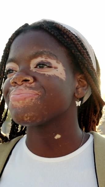 Glädjande Ung Afrikansk Flicka Med Vitiligo Känsla Positiv Stående Stadens — Stockvideo