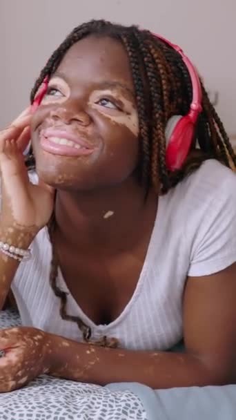 Videoclip Vertical Femeie Tânără Fericită Vitiligo Ascultând Muzică Timp Relaxează — Videoclip de stoc