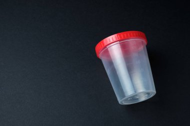 Sınav konsepti. Analiz için kavanoz