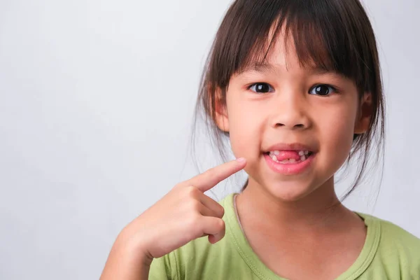 Portrét Asijské Dívky Zlomenými Horními Zuby Prvními Trvalými Zuby Přátelské — Stock fotografie