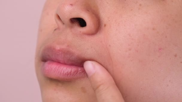 Zbliżenie Kobiety Bólem Zęba Dłońmi Dotykającymi Jej Twarzy Azjatki Cierpią — Wideo stockowe