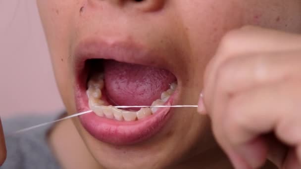 特写的笑亚洲女人和清洁为完美的笑 牙龈健康 口腔健康及牙齿护理 — 图库视频影像