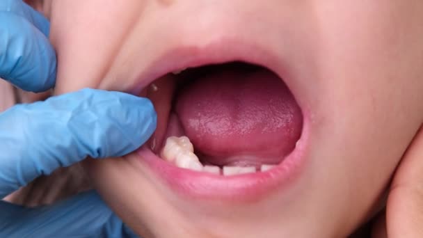在一个健康的孩子的嘴巴里 有一排漂亮的乳牙 口腔和牙齿保健概念 — 图库视频影像