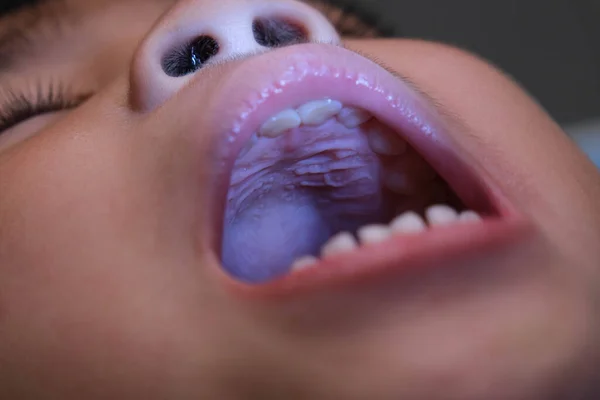 赤ちゃんの歯の美しい行を持つ健康な子供の口腔内のクローズアップ 若いです女の子は口を開きます上と下の歯を明らかに ハード味 柔らかい味 歯科と口腔健康診断 — ストック写真