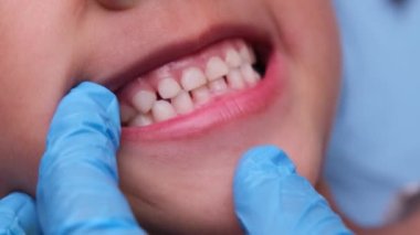 Güzel bebek dişleri olan sağlıklı bir çocuğun ağız boşluğuna yakın çekim. Genç kız ağzını açar üst ve alt dişleri, sert damak tadı, yumuşak damak, diş ve ağız sağlığı kontrollerini gösterir..