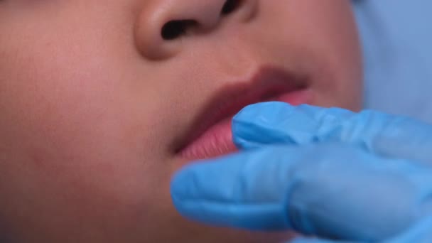 在一个有一排漂亮的婴儿牙齿的健康儿童的口腔内进行特写 小女孩张开嘴 露出上 牙齿及口腔健康检查 — 图库视频影像