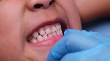 Güzel bebek dişleri olan sağlıklı bir çocuğun ağız boşluğuna yakın çekim. Genç kız ağzını açar üst ve alt dişleri, sert damak tadı, yumuşak damak, diş ve ağız sağlığı kontrollerini gösterir..