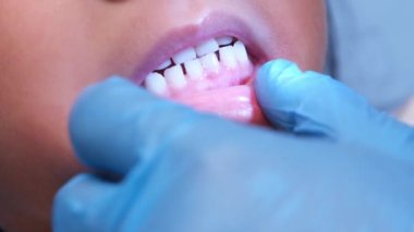 Güzel bebek dişleri olan sağlıklı bir çocuğun ağız boşluğuna yakın çekim. Genç kız ağzını açar üst ve alt dişleri, sert damak tadı, yumuşak damak, diş ve ağız sağlığı kontrollerini gösterir..