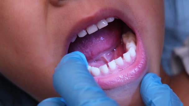 Închidere Interiorul Cavității Bucale Unui Copil Sănătos Rânduri Frumoase Dinți — Videoclip de stoc