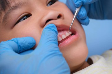 Güzel beyaz dişleri olan sağlıklı bir çocuğun ağız boşluğuna yakın çekim. Genç kız sağlıklı dişleri, sert ve yumuşak damak tadını ortaya çıkarmak için ağzını açar. Diş ve ağız sağlığı kontrolü